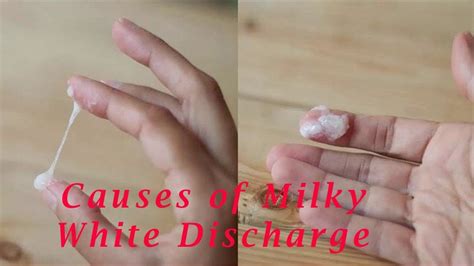 white discharge early pregnancy